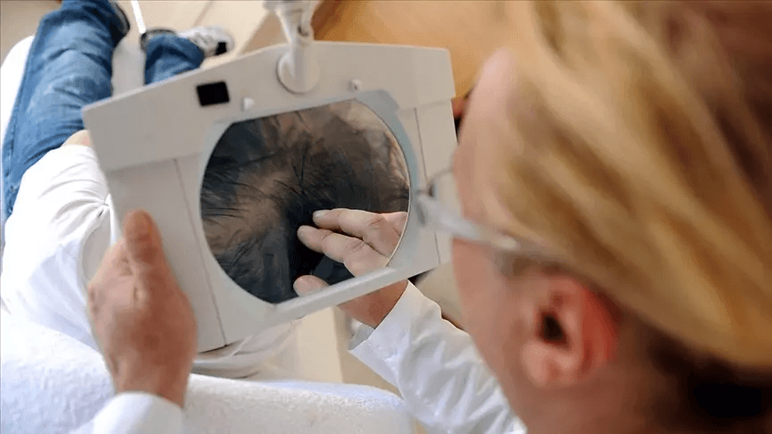 Dermatologist inspecting a patient's scalp through a magnifying lens