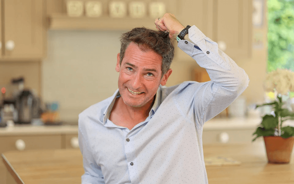 Yes, I had a hair transplant in Turkiye – and nobody would know it