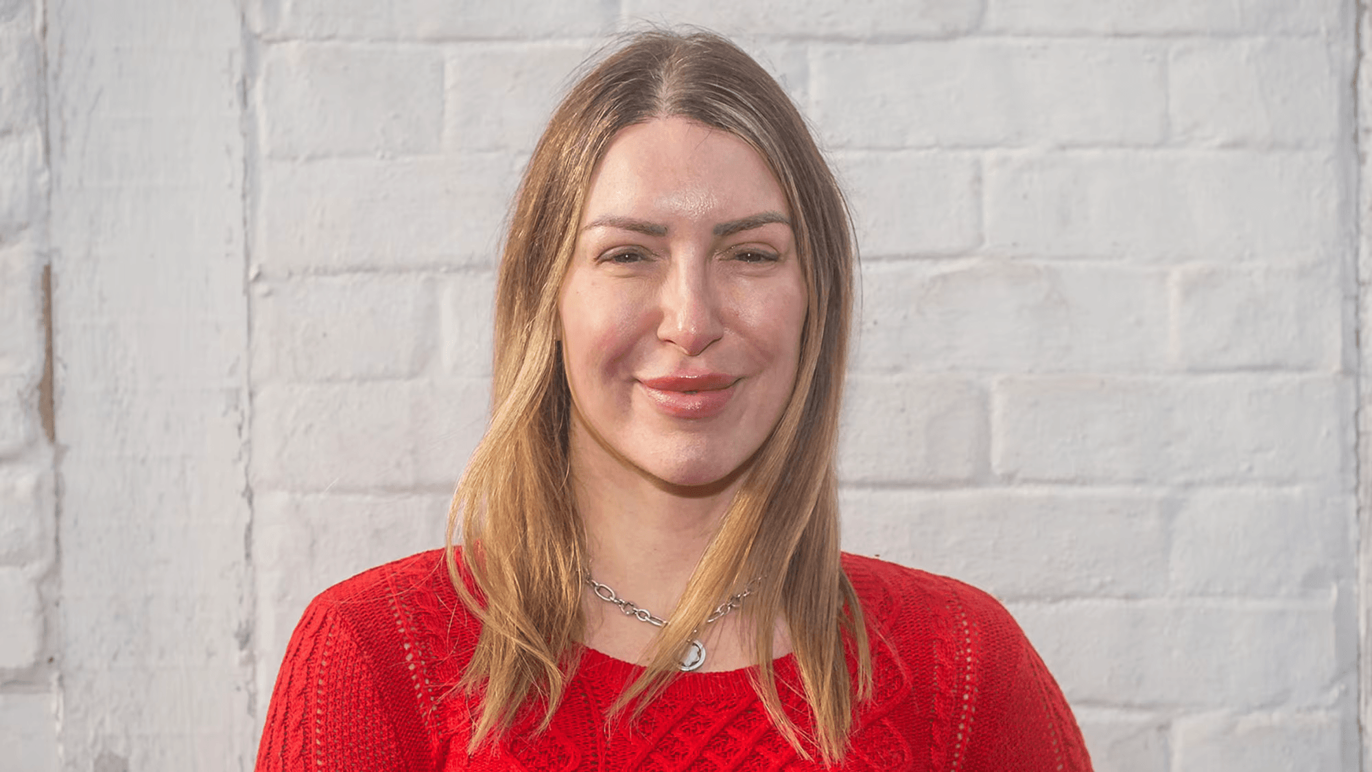 Tracy Kiss smiling after documenting her hair transplant journey