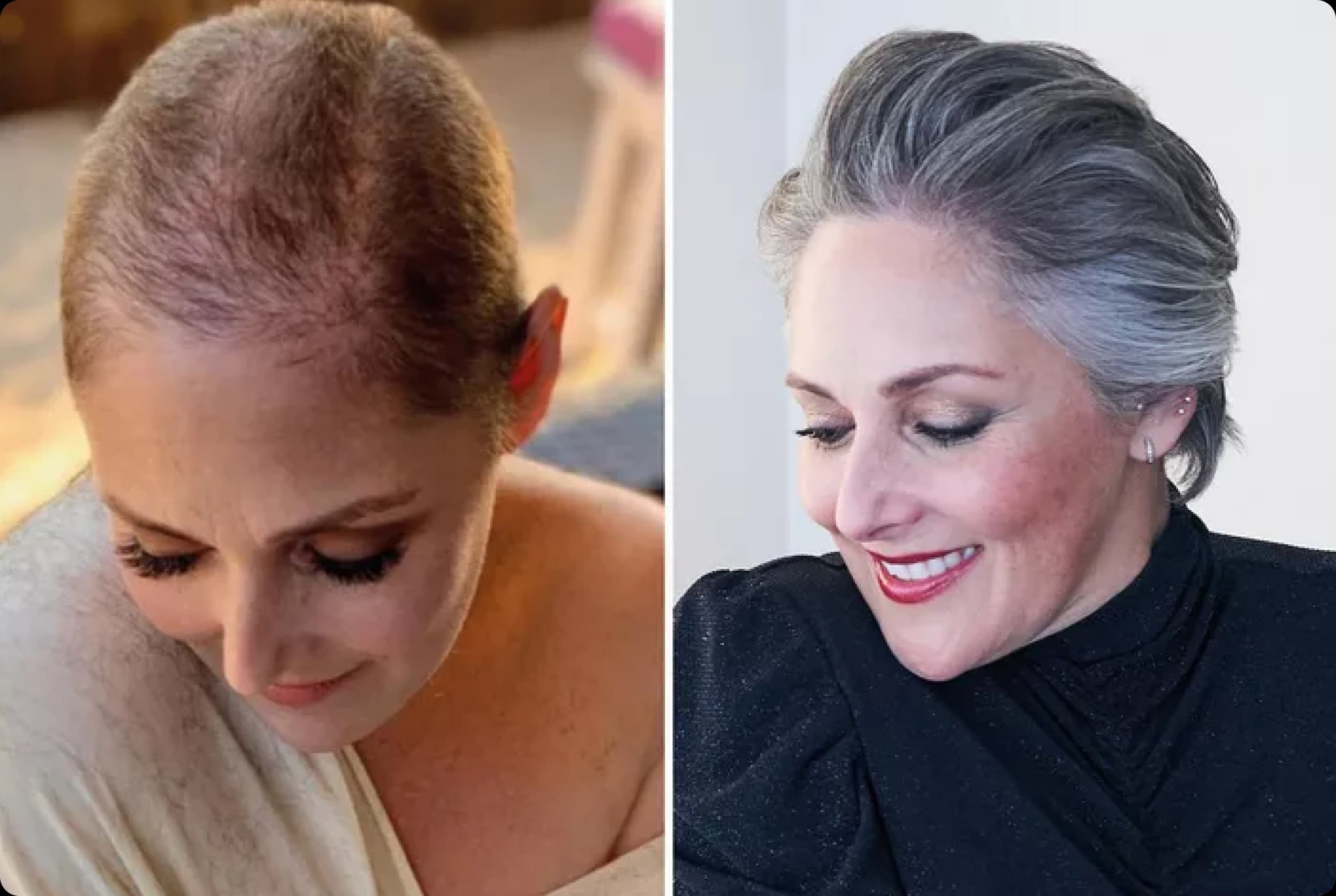 Ricki Lake before and after her hair transformation