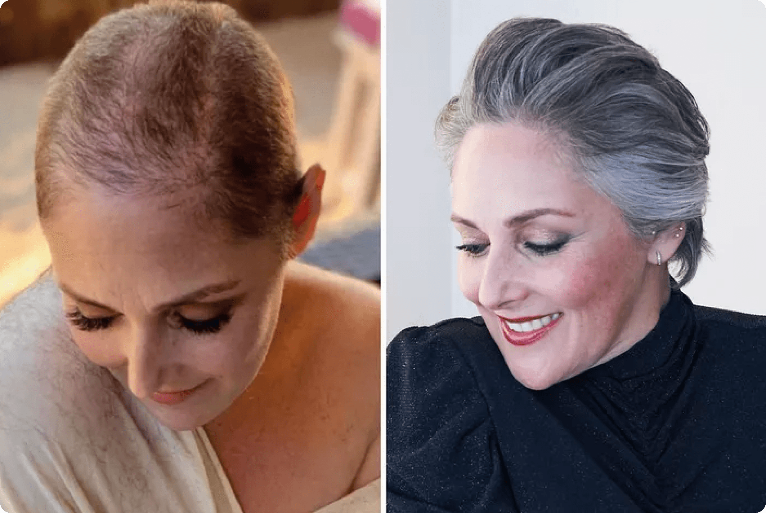 Ricki Lake before and after her hair transformation