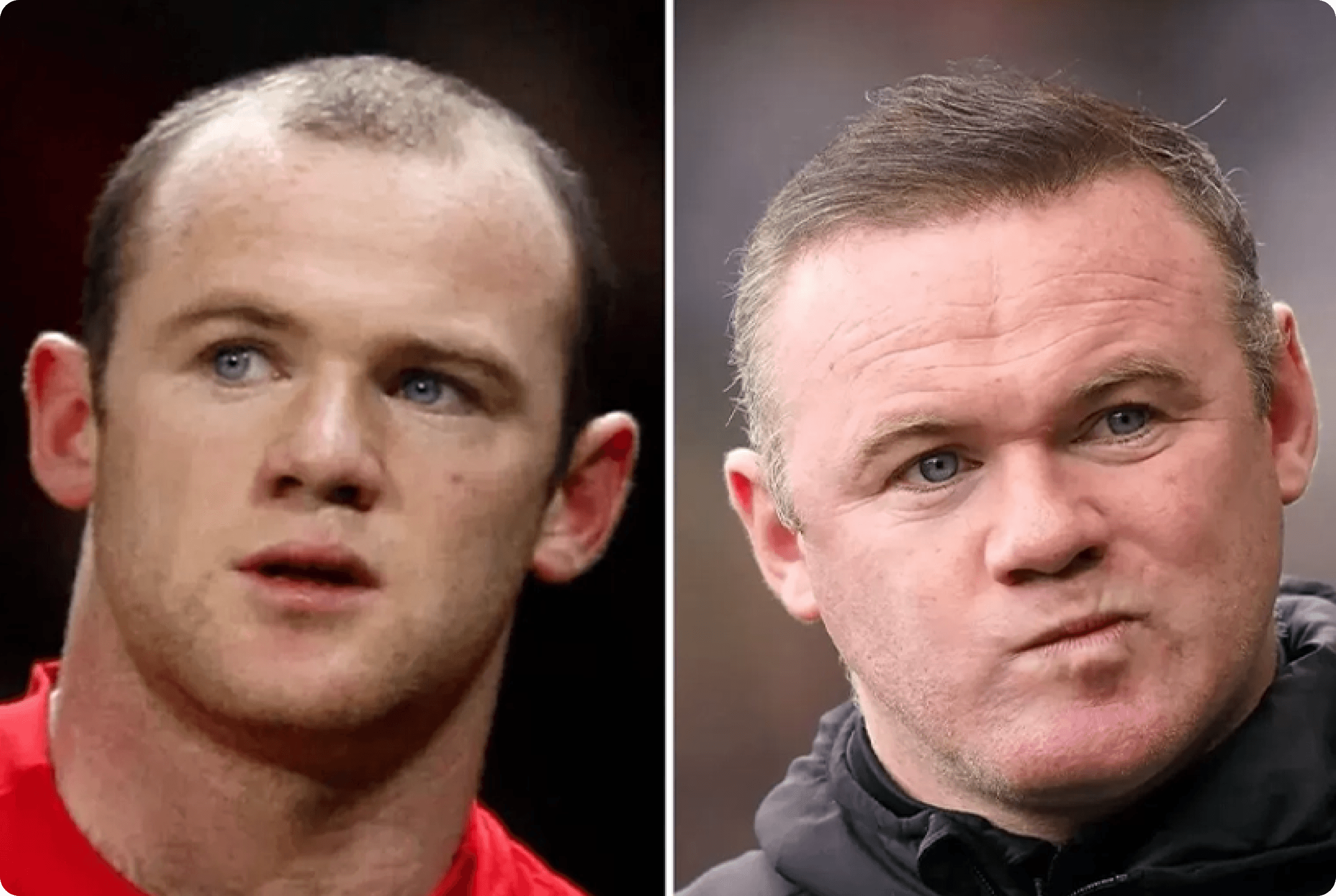 Wayne Rooney before and after treatment