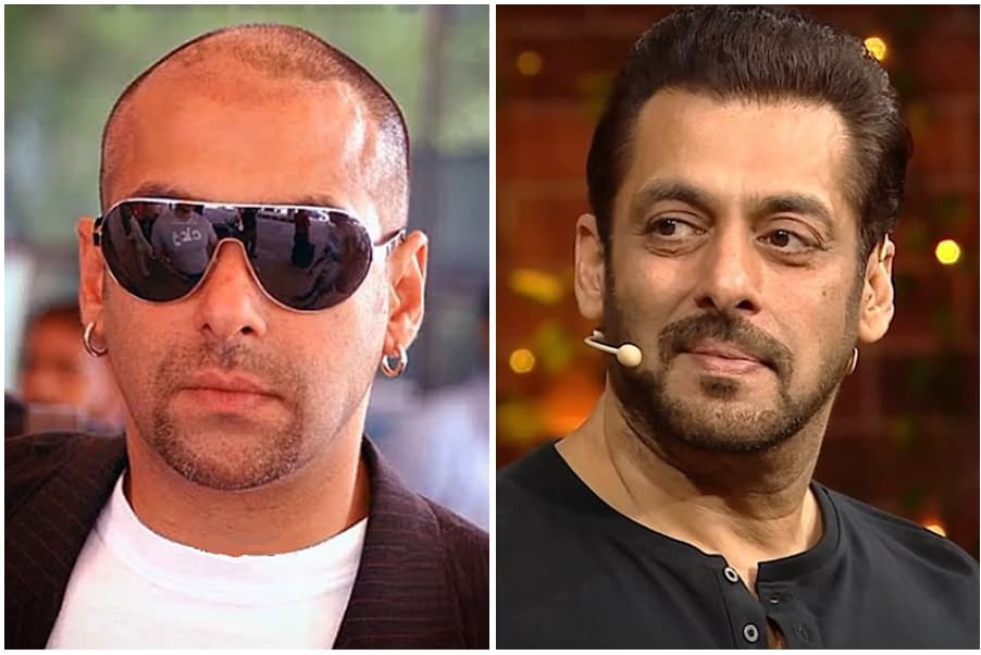 Salman Khan before and after hair restoration