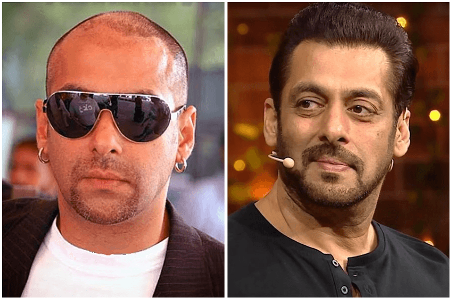 Salman Khan before and after hair restoration