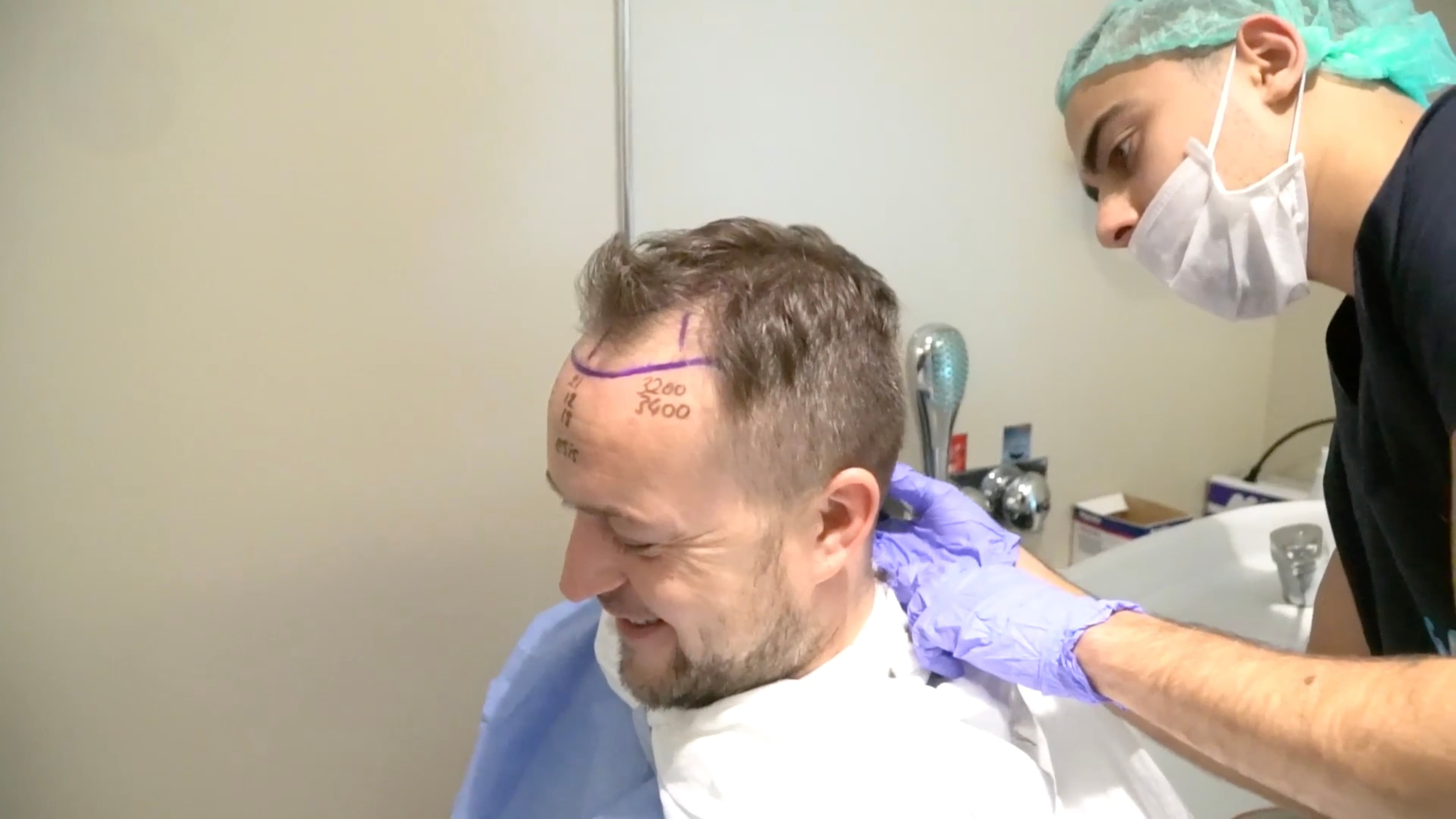 Hair transplant planning session