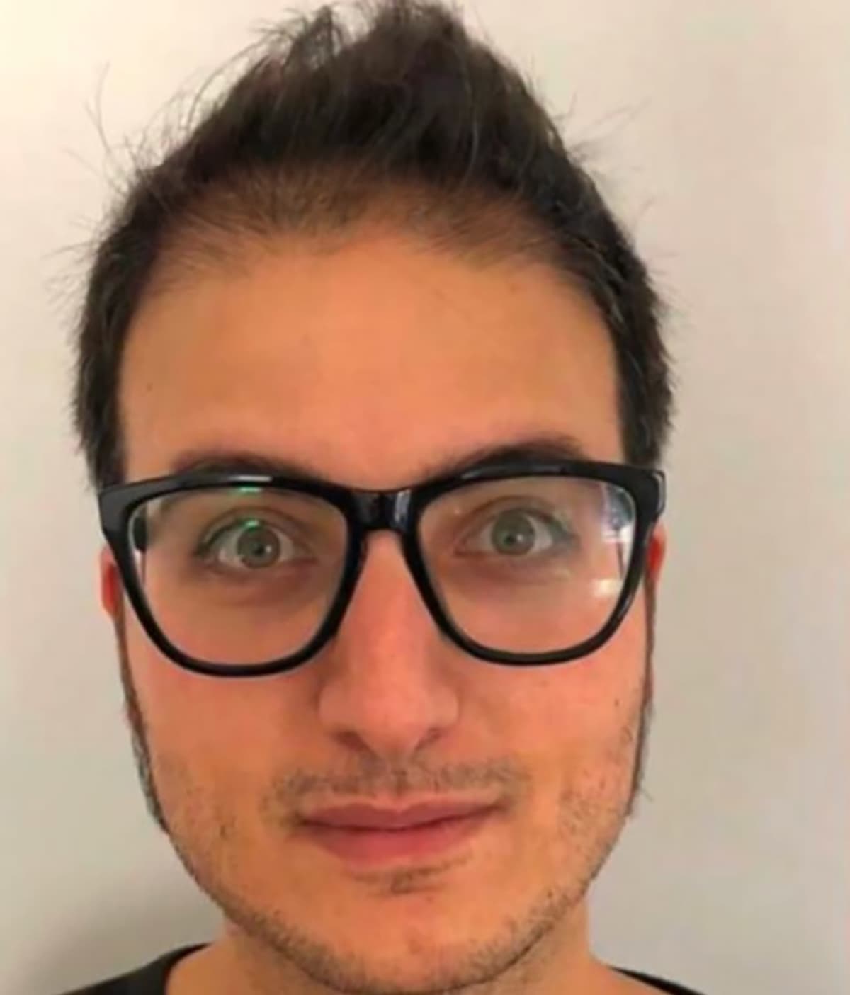 Before transformation