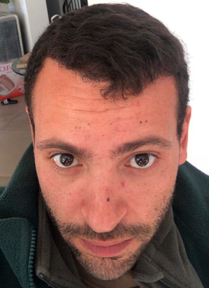 After transformation