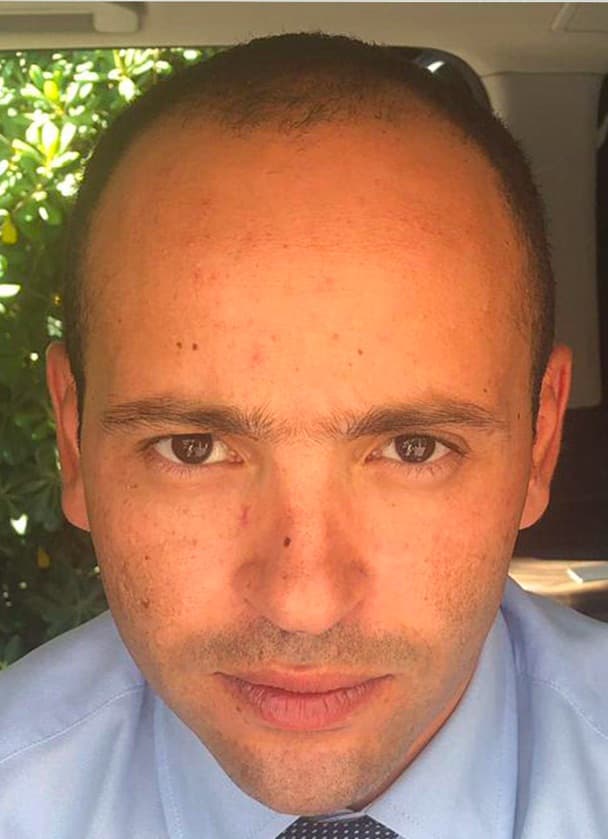 Before transformation