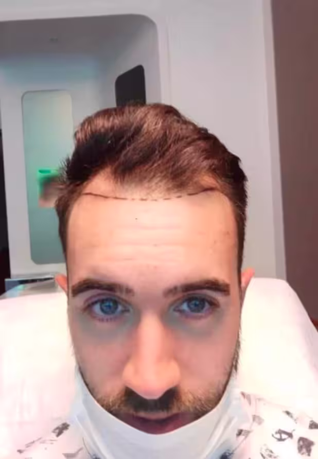 Before transformation