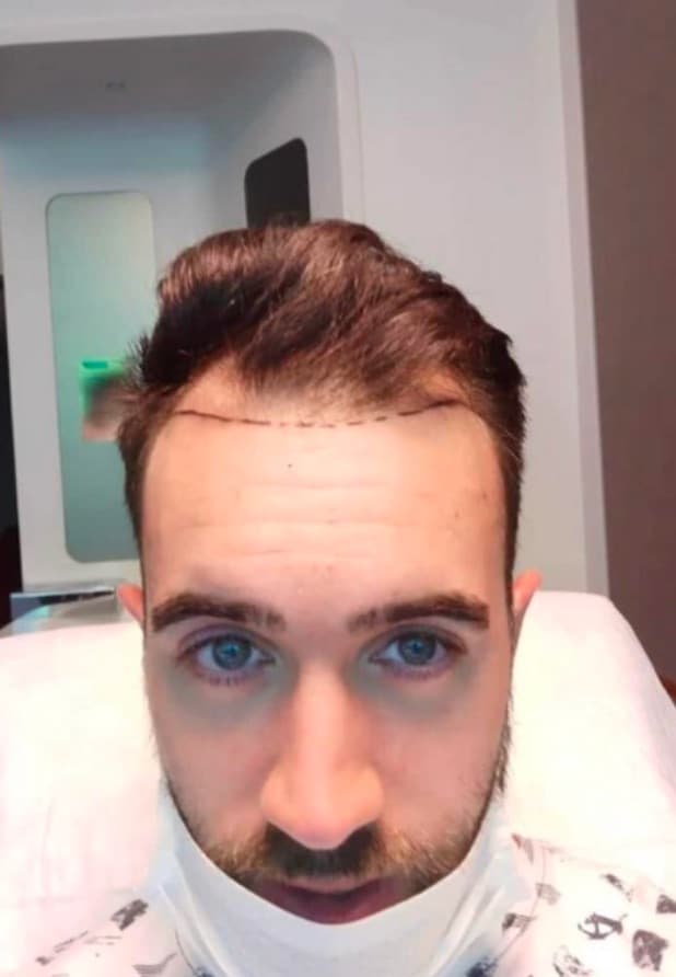 Before transformation