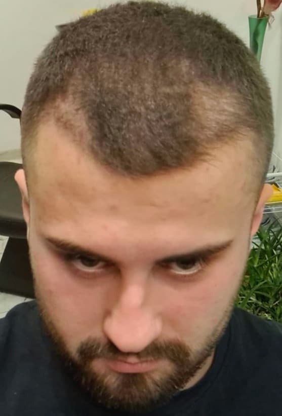 Before transformation