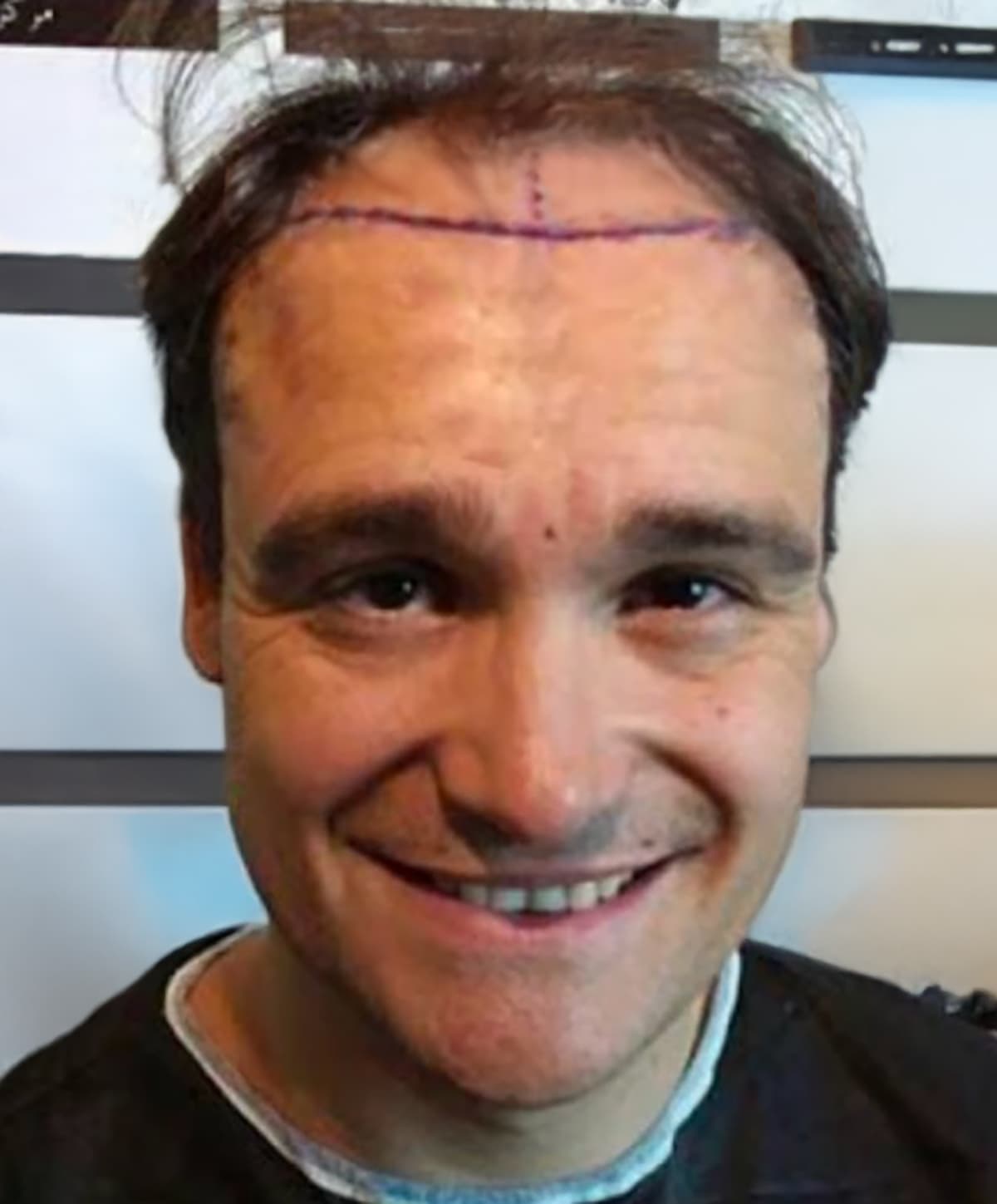 Before transformation