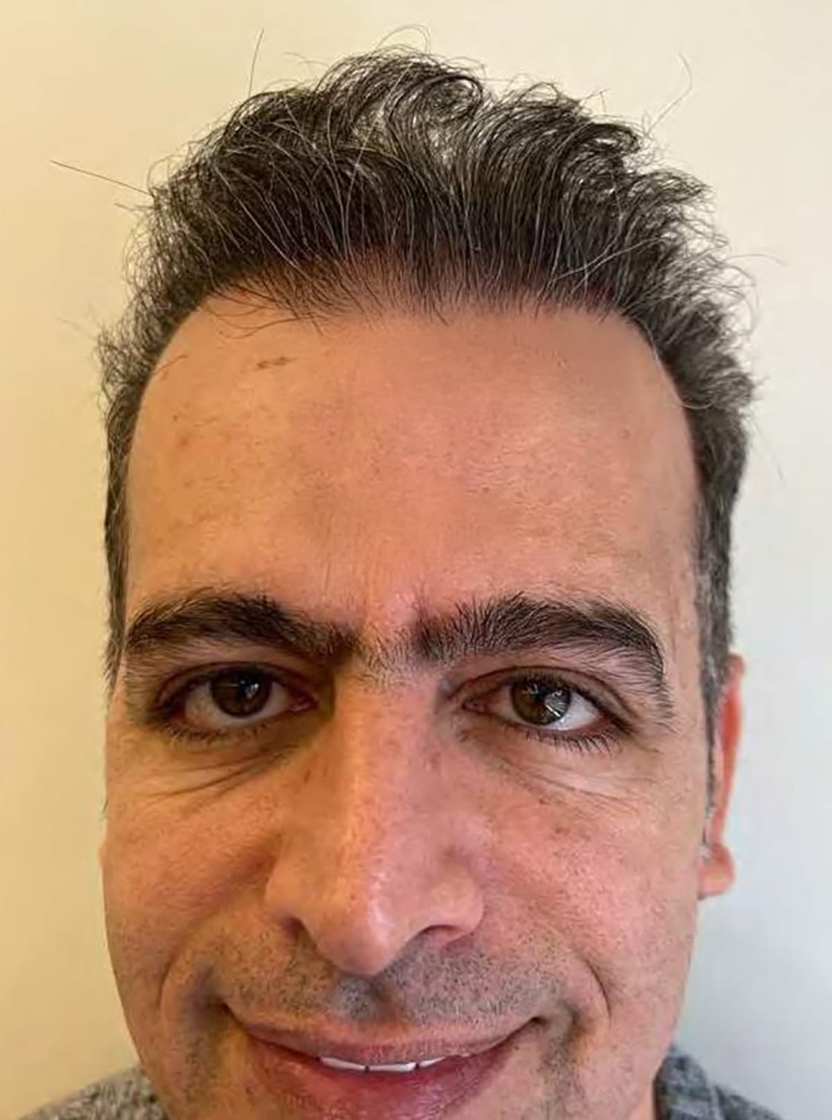 After transformation