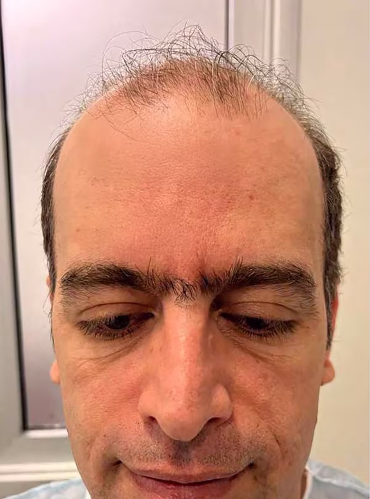 Before transformation