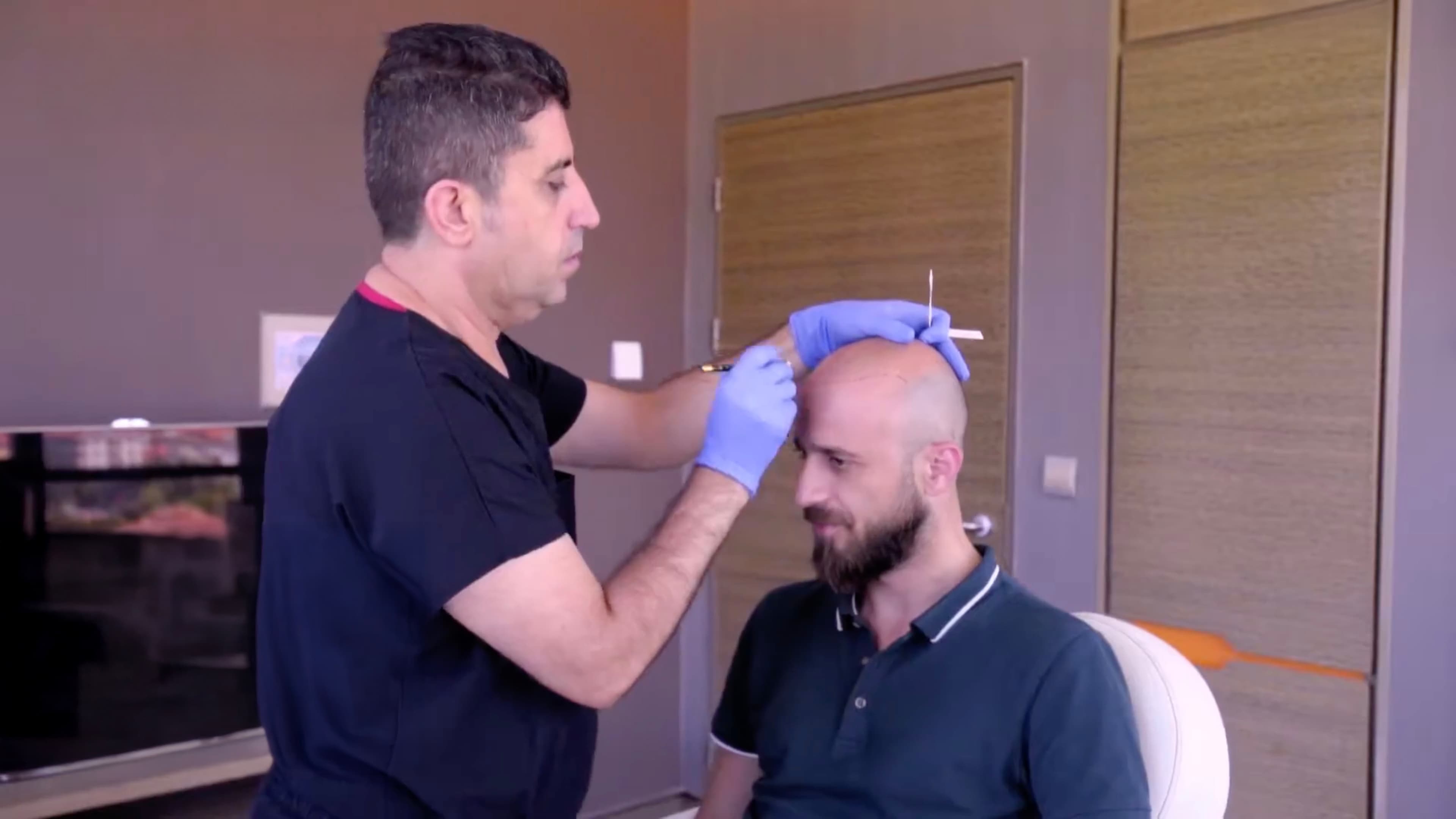 No-Shave FUE procedure